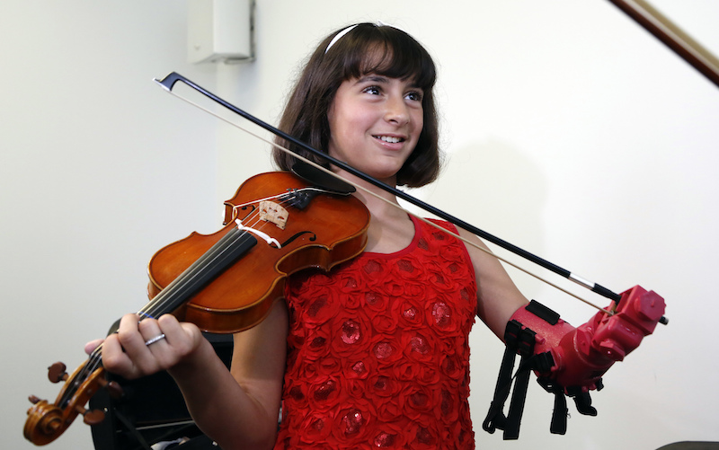 Prosthetic arm for 10-year old violinist